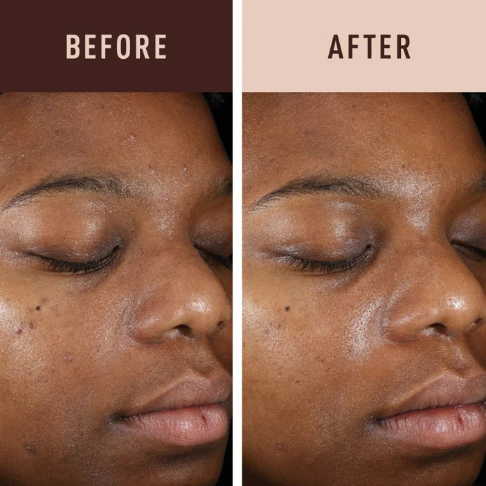 AMBI Fade Serum Retinol Hydroquinone-Free
